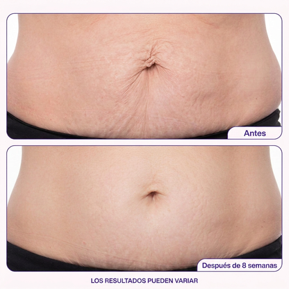 Belamia GoPure Skin Repair