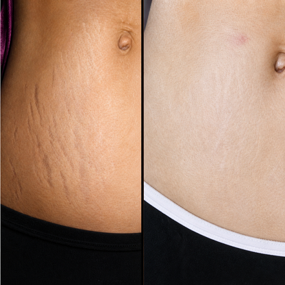 Belamia GoPure Skin Repair