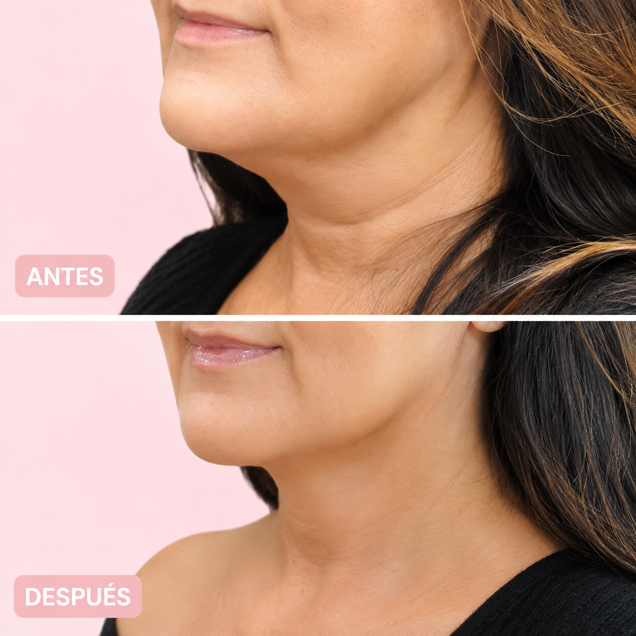 Crema Antiarrugas de Cuello PDRN Colágeno